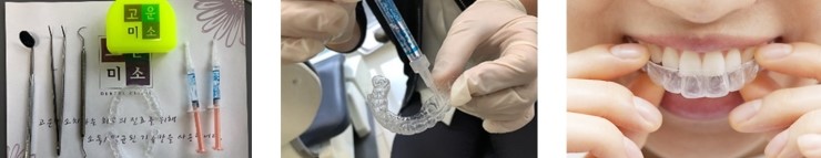 오목교역치과 자가미백