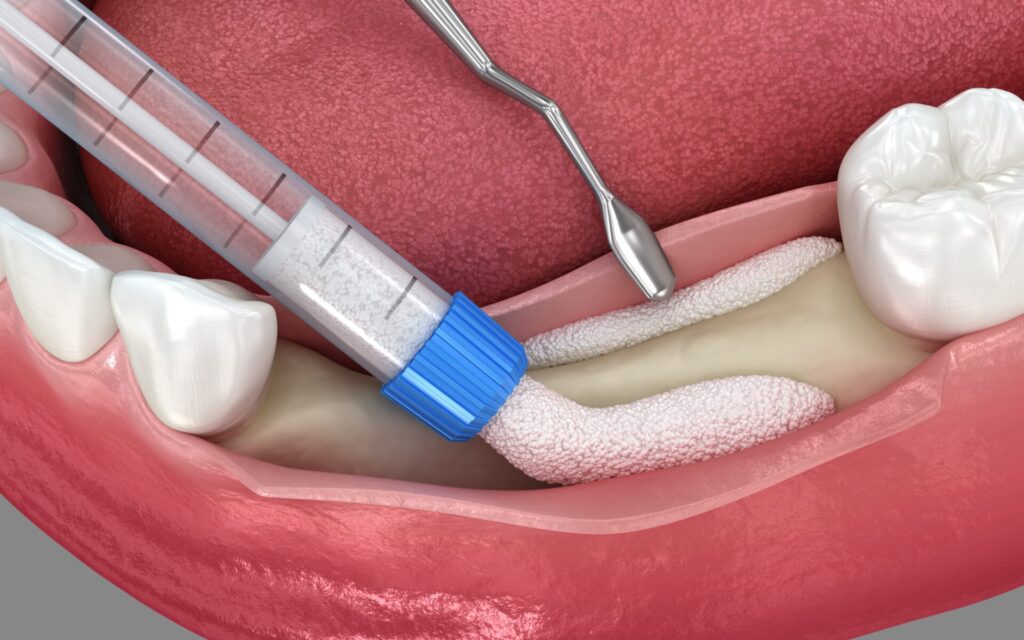 목동치과 임플란트