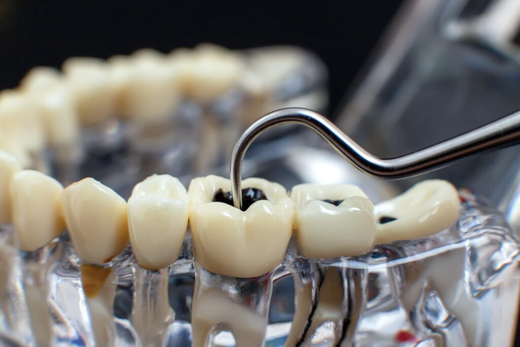 목동치과 충치치료