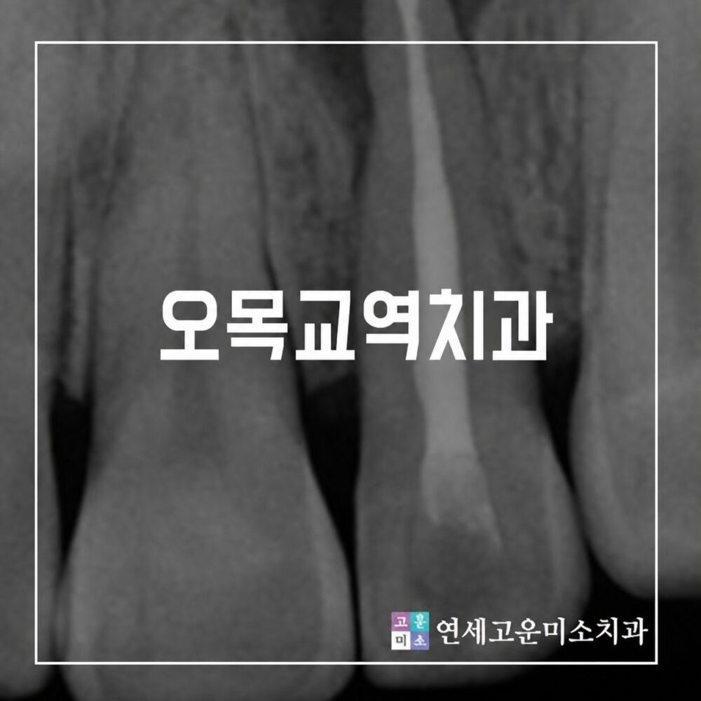 오목교역치과 신경 손상 치아 치료를 미루면 문제가 커지는 이유와 주의사항